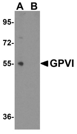 GP6 Polyclonal Antibody, Invitrogen 100 &mu;g; Unconjugated:Antibodies