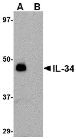 Invitrogen IL-34 Polyclonal Antibody 100 &mu;g | Buy Online | Invitrogen&trade; | Fisher Scientific