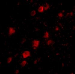 Invitrogen POLR3F Polyclonal Antibody 100 &mu;g; Unconjugated:Antibodies,