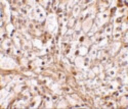Invitrogen TRIM30 Polyclonal Antibody 100 &mu;g | Buy Online | Invitrogen&trade; | Fisher Scientific