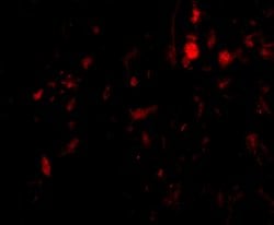 Invitrogen Calpain 6 Polyclonal Antibody 100 &mu;g; Unconjugated:Antibodies,