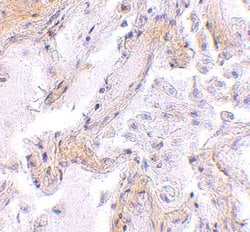 Invitrogen Calpain 6 Polyclonal Antibody 100 &mu;g; Unconjugated:Antibodies,