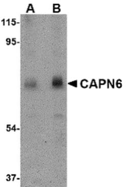 Invitrogen Calpain 6 Polyclonal Antibody 100 &mu;g; Unconjugated:Antibodies,