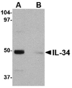 Invitrogen IL-34 Polyclonal Antibody 100 μg; Unconjugated:Antibodies,