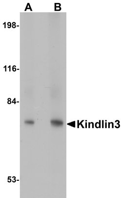 Invitrogen Kindlin 3 Polyclonal Antibody 100 &mu;g | Buy Online | Invitrogen&trade; | Fisher Scientific