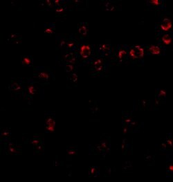 Invitrogen ITGA4 Polyclonal Antibody 100 &mu;g | Buy Online | Invitrogen&trade; | Fisher Scientific