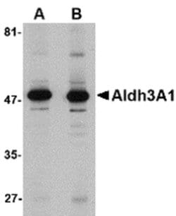 Invitrogen ALDH3A1 Polyclonal Antibody 100 &mu;g; Unconjugated:Antibodies,
