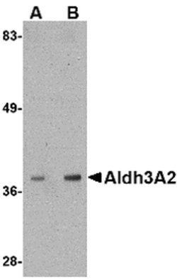 Invitrogen ALDH3A2 Polyclonal Antibody 100 &mu;g; Unconjugated:Antibodies,