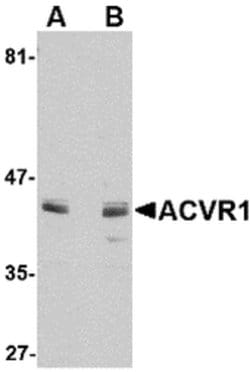 Invitrogen ACVR1 Polyclonal Antibody 100 &mu;g; Unconjugated:Antibodies,