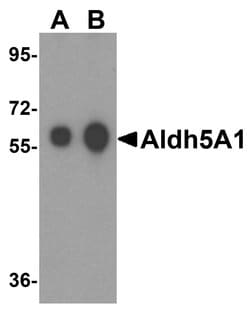 Invitrogen ALDH5A1 Polyclonal Antibody 100 &mu;g; Unconjugated:Antibodies,