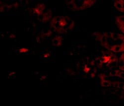 Invitrogen OTUD5 Polyclonal Antibody 100 &mu;g; Unconjugated:Antibodies,
