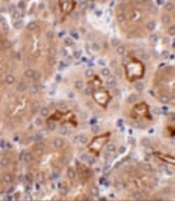 Invitrogen OTUD5 Polyclonal Antibody 100 &mu;g; Unconjugated:Antibodies,