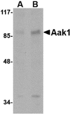 Invitrogen AAK1 Polyclonal Antibody 100 &mu;g; Unconjugated:Antibodies,