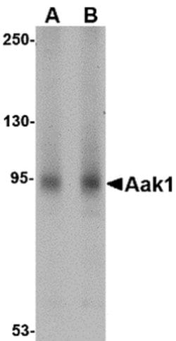 Invitrogen AAK1 Polyclonal Antibody 100 &mu;g; Unconjugated:Antibodies,
