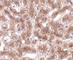 Invitrogen CUEDC1 Polyclonal Antibody 100 &mu;g | Buy Online | Invitrogen&trade; | Fisher Scientific