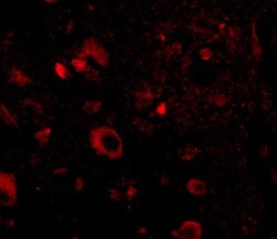 Invitrogen AIPL1 Polyclonal Antibody 100 &mu;g; Unconjugated:Antibodies,