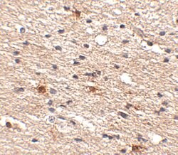 Invitrogen AIPL1 Polyclonal Antibody 100 &mu;g; Unconjugated:Antibodies,