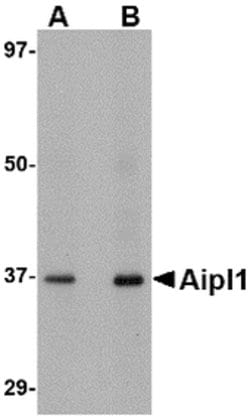 Invitrogen AIPL1 Polyclonal Antibody 100 &mu;g; Unconjugated:Antibodies,