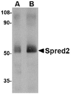 Invitrogen SPRED2 Polyclonal Antibody 100 &mu;g; Unconjugated:Antibodies,
