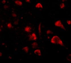 Invitrogen SPRED3 Polyclonal Antibody 100 &mu;g; Unconjugated:Antibodies,
