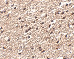 Invitrogen STK39 Polyclonal Antibody 100 &mu;g; Unconjugated:Antibodies,