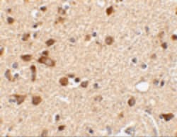 Invitrogen STK39 Polyclonal Antibody 100 &mu;g; Unconjugated:Antibodies,