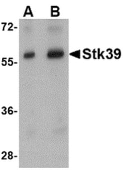 Invitrogen STK39 Polyclonal Antibody 100 &mu;g; Unconjugated:Antibodies,