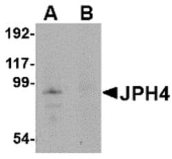 Invitrogen JPH4 Polyclonal Antibody 100 &mu;g; Unconjugated:Antibodies,