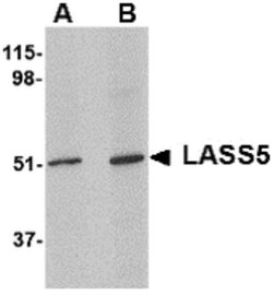 Invitrogen Lass5 Polyclonal Antibody 100 &mu;g; Unconjugated:Antibodies,