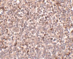 Invitrogen PIGY Polyclonal Antibody 100 &mu;g; Unconjugated:Antibodies,