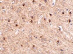 Invitrogen TOM70 Polyclonal Antibody 100 &mu;g | Buy Online | Invitrogen&trade; | Fisher Scientific