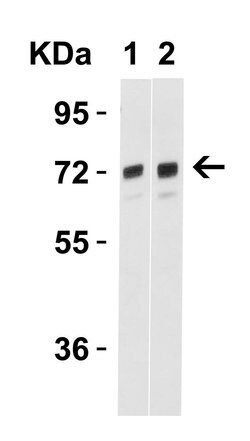 Invitrogen TOM70 Polyclonal Antibody 100 &mu;g | Buy Online | Invitrogen&trade; | Fisher Scientific