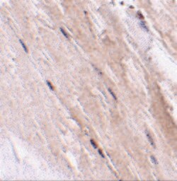 Invitrogen GBAS Polyclonal Antibody 100 μg; Unconjugated:Antibodies,