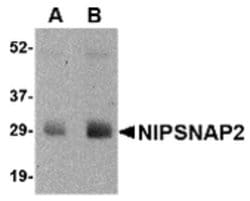 Invitrogen GBAS Polyclonal Antibody 100 μg; Unconjugated:Antibodies,