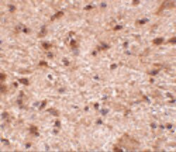 Invitrogen NIPSNAP3B Polyclonal Antibody 100 &mu;g; Unconjugated:Antibodies,