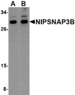 Invitrogen NIPSNAP3B Polyclonal Antibody 100 &mu;g; Unconjugated:Antibodies,
