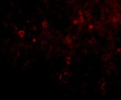 EBI3 Polyclonal Antibody, Invitrogen 100 &mu;g; Unconjugated:Antibodies