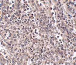 EBI3 Polyclonal Antibody, Invitrogen 100 &mu;g; Unconjugated:Antibodies