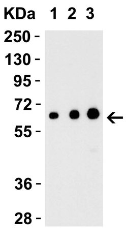 EBI3 Polyclonal Antibody, Invitrogen 100 &mu;g; Unconjugated:Antibodies