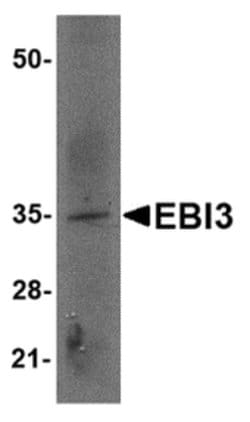 EBI3 Polyclonal Antibody, Invitrogen 100 &mu;g; Unconjugated:Antibodies