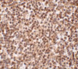 Invitrogen TREX1 Polyclonal Antibody 100 &mu;g | Buy Online | Invitrogen&trade; | Fisher Scientific