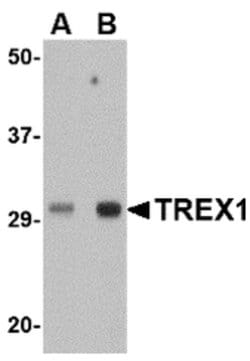 Invitrogen TREX1 Polyclonal Antibody 100 &mu;g | Buy Online | Invitrogen&trade; | Fisher Scientific