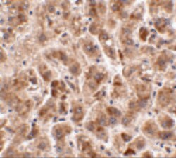 Invitrogen TREX2 Polyclonal Antibody 100 &mu;g | Buy Online | Invitrogen&trade; | Fisher Scientific