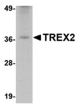 Invitrogen TREX2 Polyclonal Antibody 100 &mu;g | Buy Online | Invitrogen&trade; | Fisher Scientific
