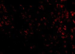 Invitrogen KLRA1 Polyclonal Antibody 100 &mu;g; Unconjugated:Antibodies,