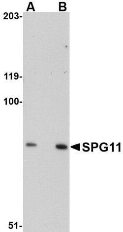 Invitrogen SPG11 Polyclonal Antibody 100 &mu;g; Unconjugated:Antibodies,