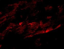 Invitrogen ZFYVE26 Polyclonal Antibody 100 &mu;g; Unconjugated:Antibodies,