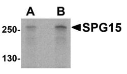 Invitrogen ZFYVE26 Polyclonal Antibody 100 &mu;g; Unconjugated:Antibodies,