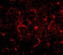 Invitrogen CDIP1 Polyclonal Antibody 100 &mu;g; Unconjugated:Antibodies,