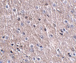 Invitrogen CDIP1 Polyclonal Antibody 100 &mu;g; Unconjugated:Antibodies,